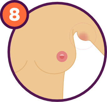 Breast Cancer Signs and Symptoms: An unusual swelling in the armpit.