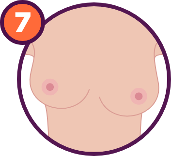Breast Cancer Signs and Symptoms: One breast unusually lower than the other. Nipples at different levels.