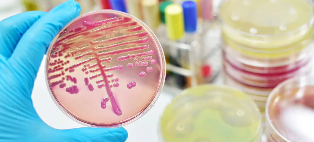 Get to Know the Signs and Symptoms of Sepsis | UPMC Ireland