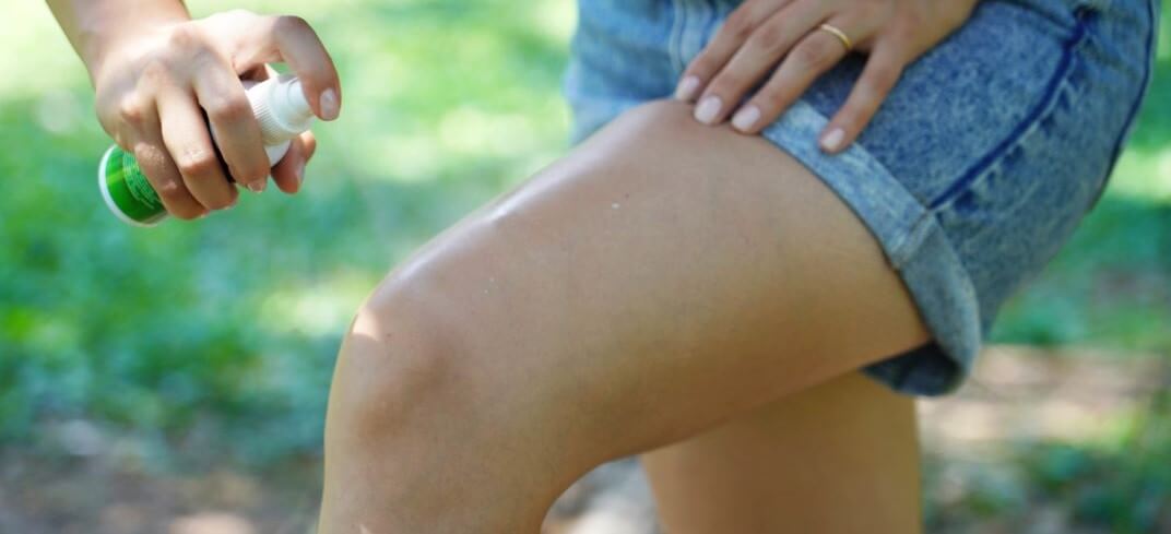 Skin Cancer and Sun Damage Prevention | UPMC Ireland