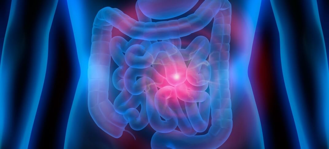 Recognising Normal Bowel Patterns and Knowing When to Seek Help | UPMC Ireland