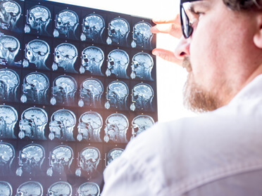 Istituto neurologico 