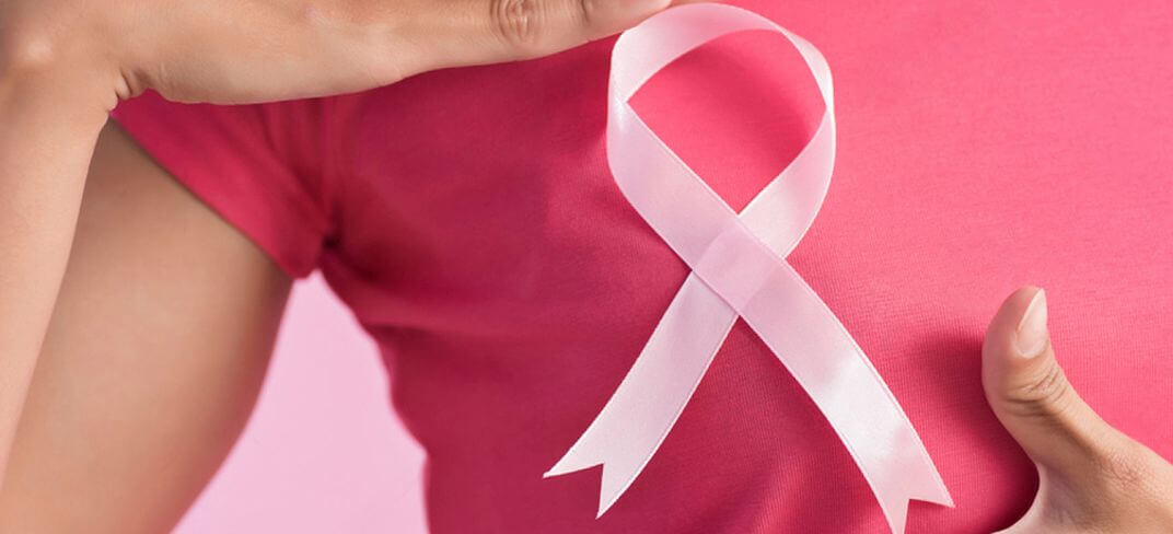 Breast Cancer Risk Factors | UPMC Italy