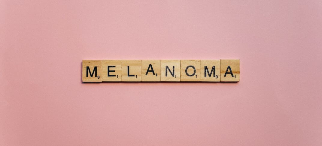 Melanoma: falsi miti e verità? | UPMC Italy