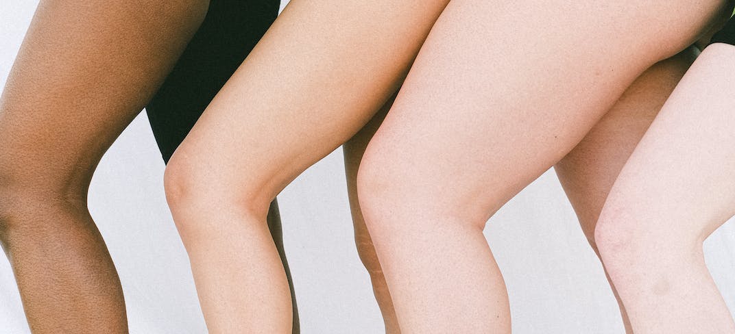 Swollen Legs: Causes and Therapies. Interview with Dr. Marco Franceschini| UPMC Italy