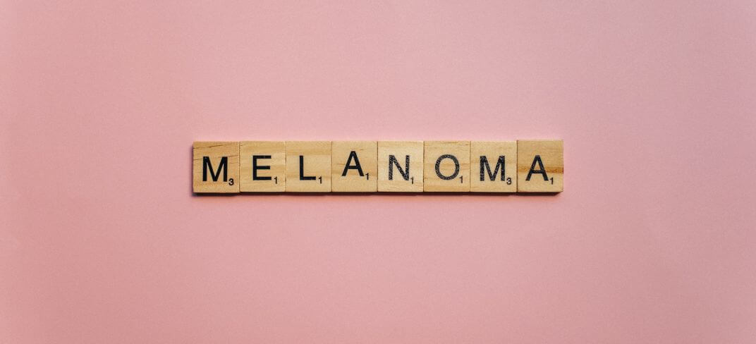 Can You Tell Melanoma Facts From Myths? | UPMC Italy