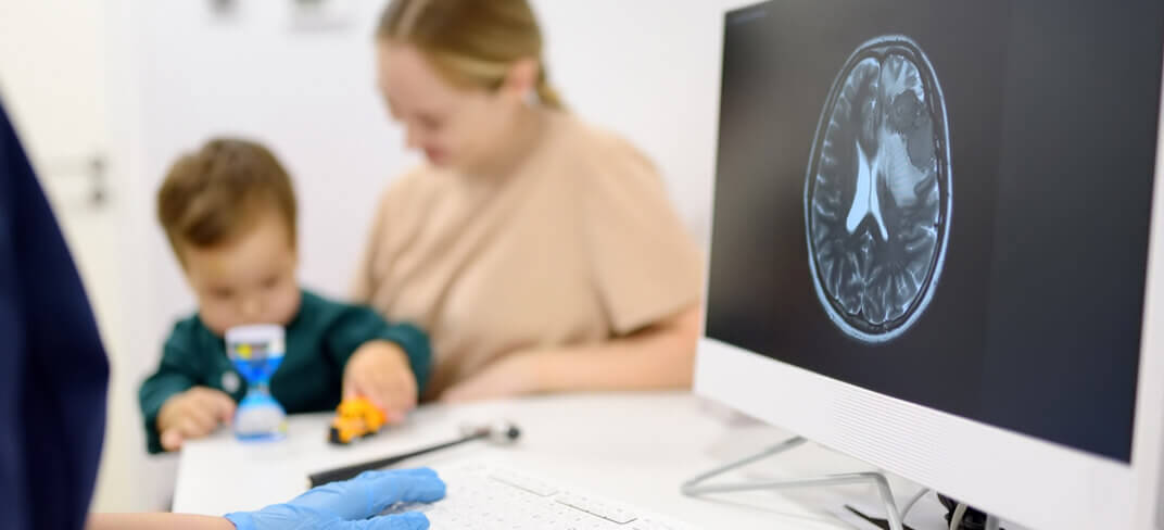 Childhood Brain Tumors: A New Approach to Diagnosis and Treatment | UPMC Italy