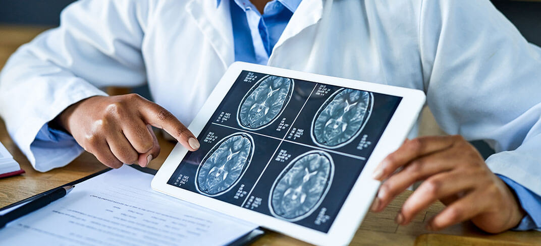 Doctor holds neurology brain scan