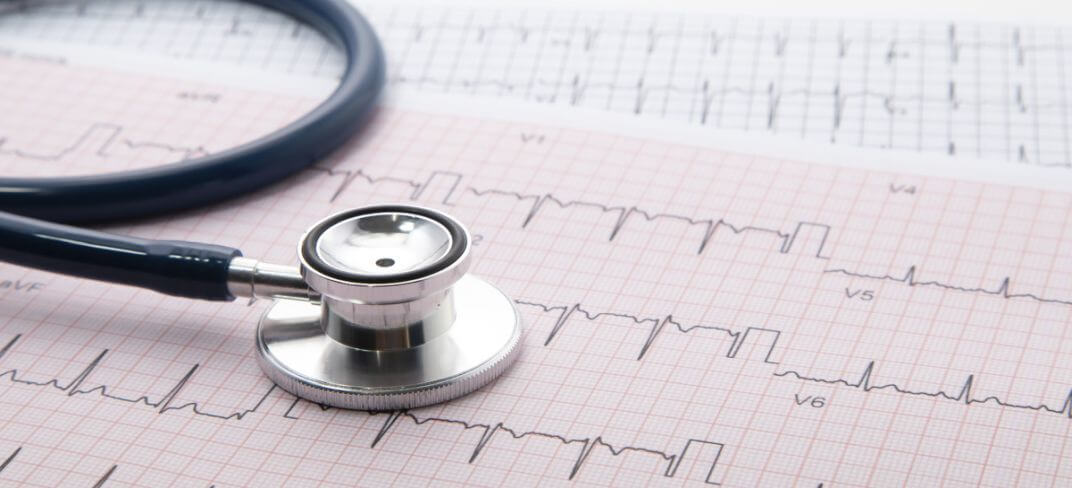 The Importance of Cardiac Diagnostic Tests. Interview with Dr. Massimo Uguccioni. | UPMC Italy